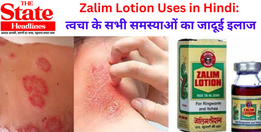 Zalim Lotion Uses in Hindi