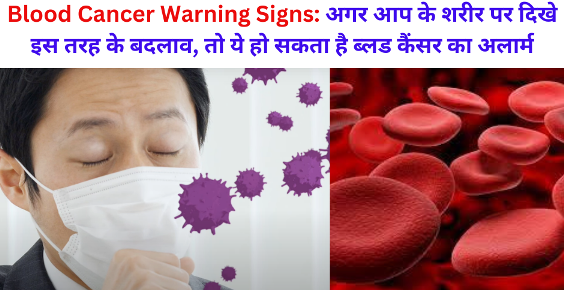 Blood Cancer Warning Signs