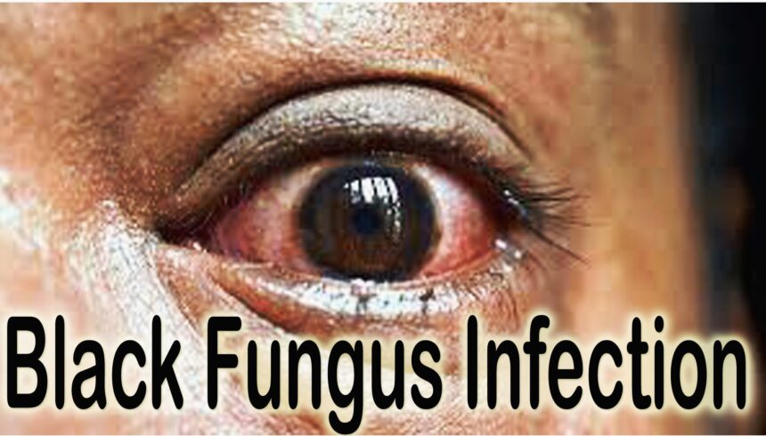 Symptoms of Black Fungus