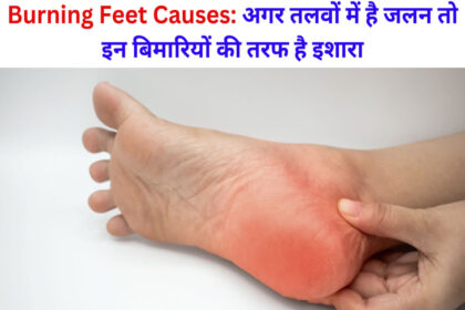 Burning Feet Causes