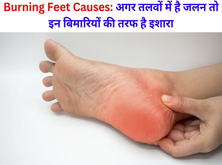 Burning Feet Causes