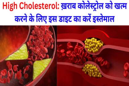 High Cholesterol