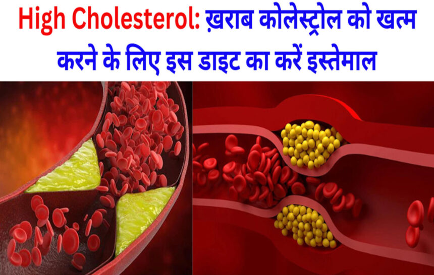 High Cholesterol