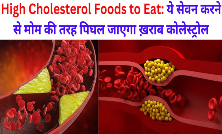 High Cholesterol Foods to Eat