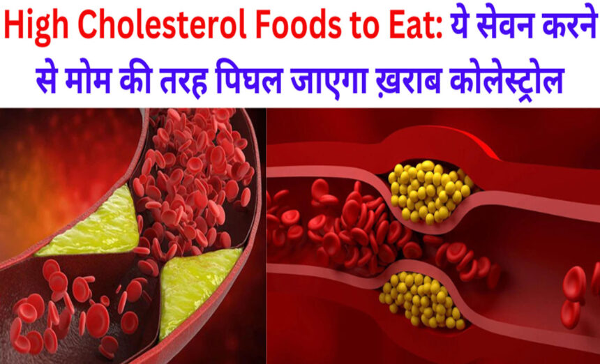 High Cholesterol Foods to Eat