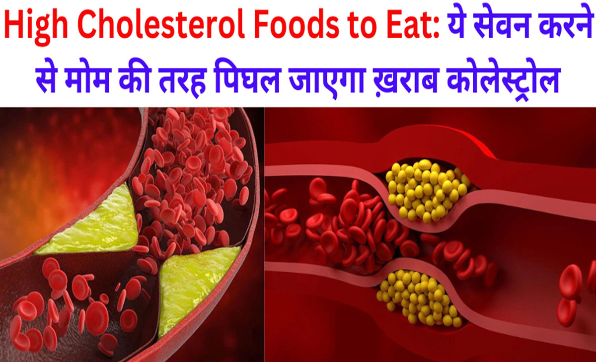 High Cholesterol Foods to Eat