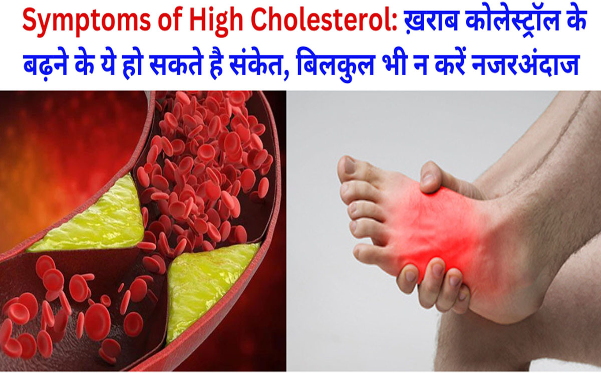 Symptoms of High Cholesterol