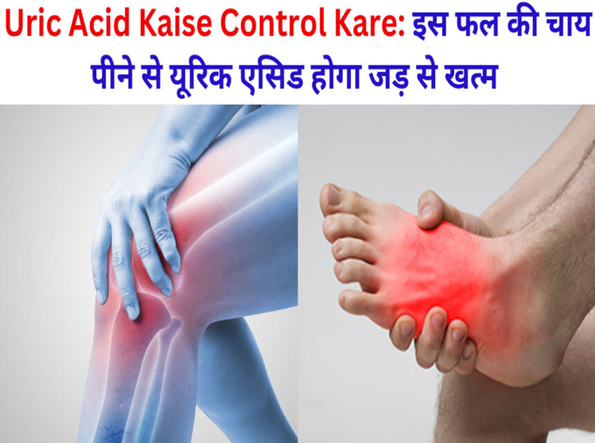 Uric Acid Kaise Control Kare