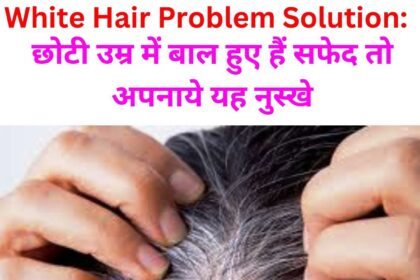 White Hair Home Remedies