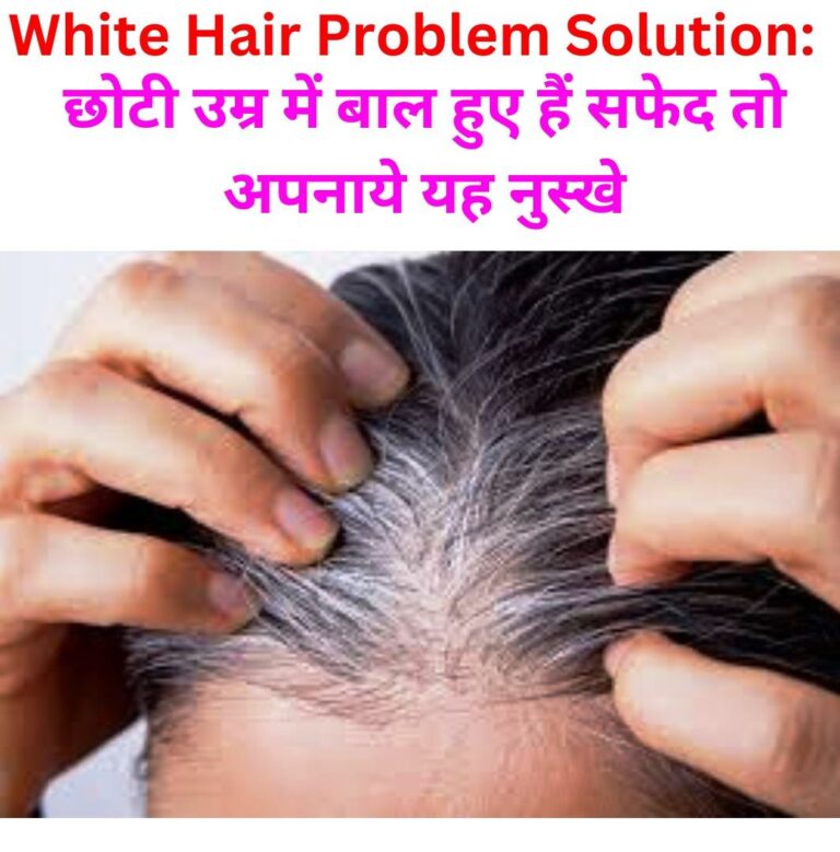 White Hair Home Remedies