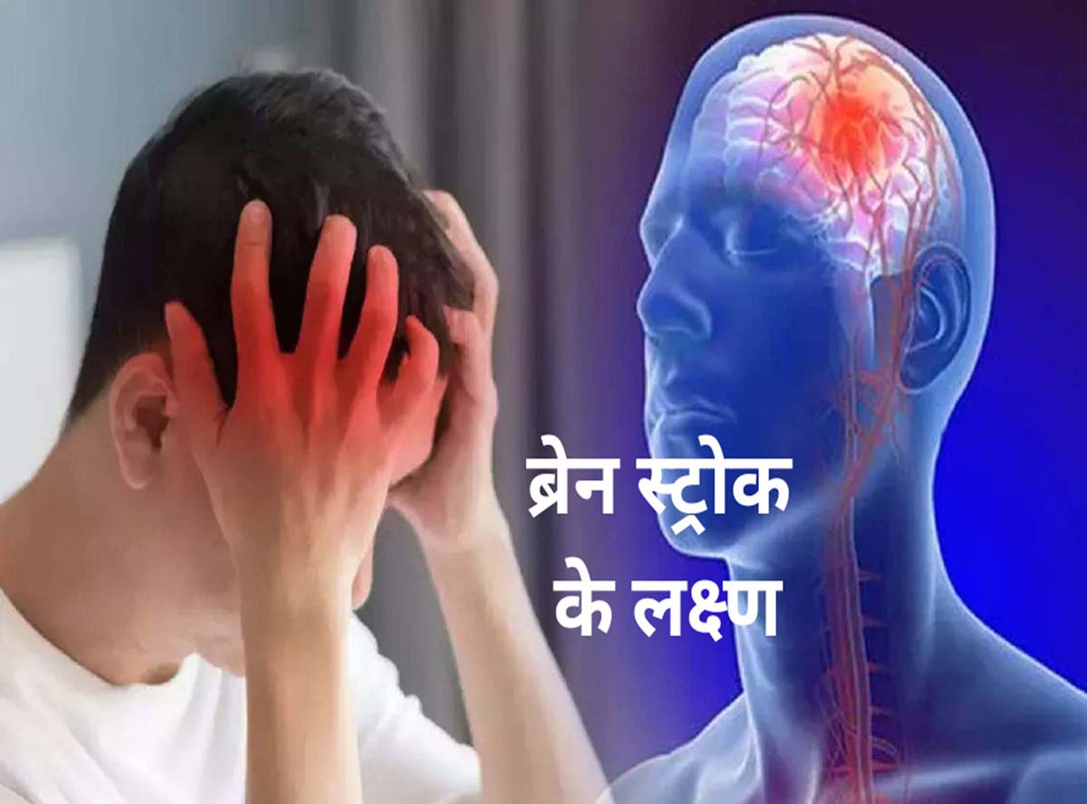 Brain Stroke