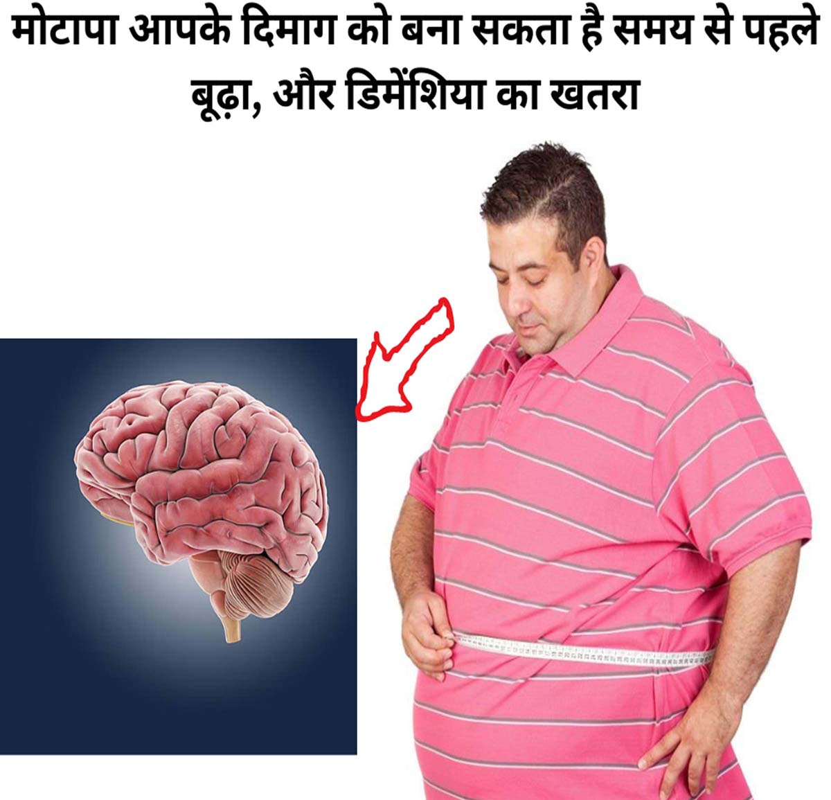 Causes of Obesity