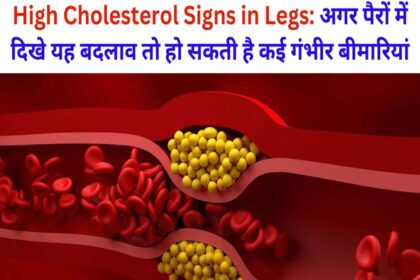 High Cholesterol Signs in Legs