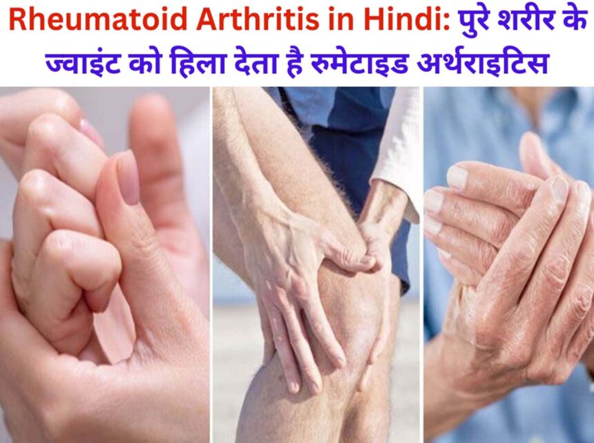 Rheumatoid Arthritis in Hindi