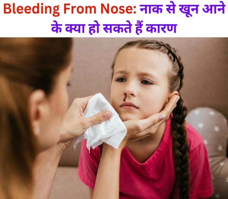 Bleeding From Nose