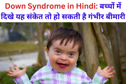 Down Syndrome in Hindi