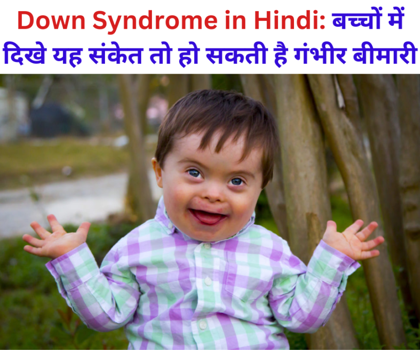 Down Syndrome in Hindi